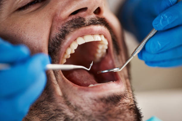 Best Dentist for Tooth Abscess  in Centreville, AL